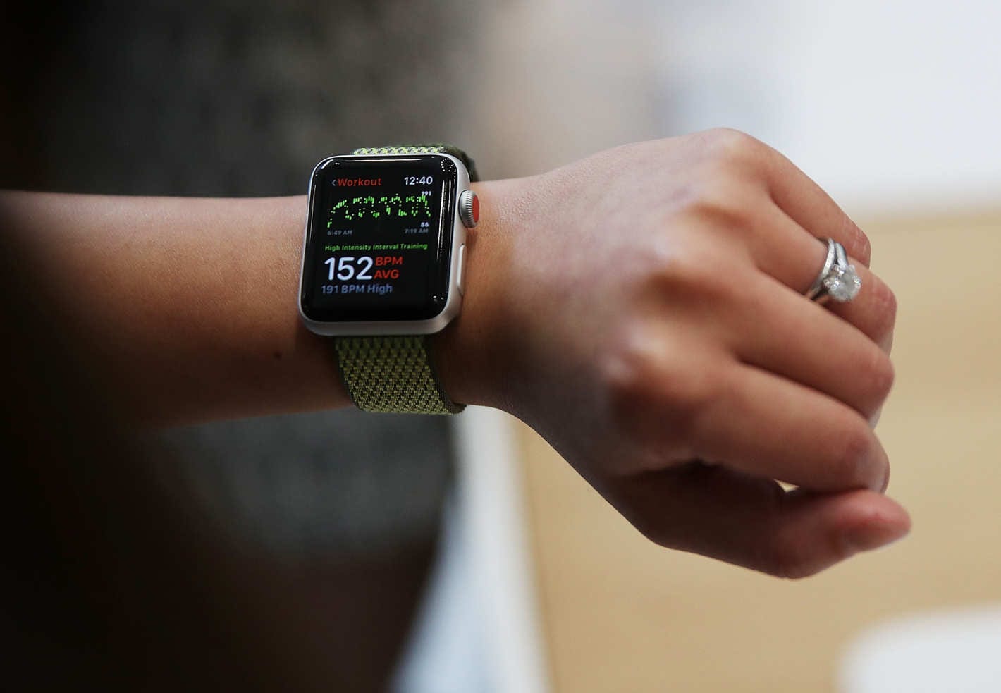 Apple Watch The Next Modern Medical Device The Plug HelloTech